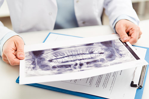 Everyday Habits to Avoid for Healthier Teeth